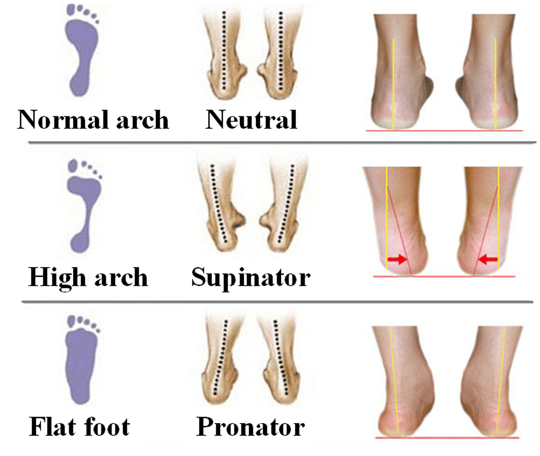 Identifying Your Foot Type & Gait
